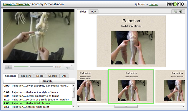 Dimostrazione dell'anatomia EMU